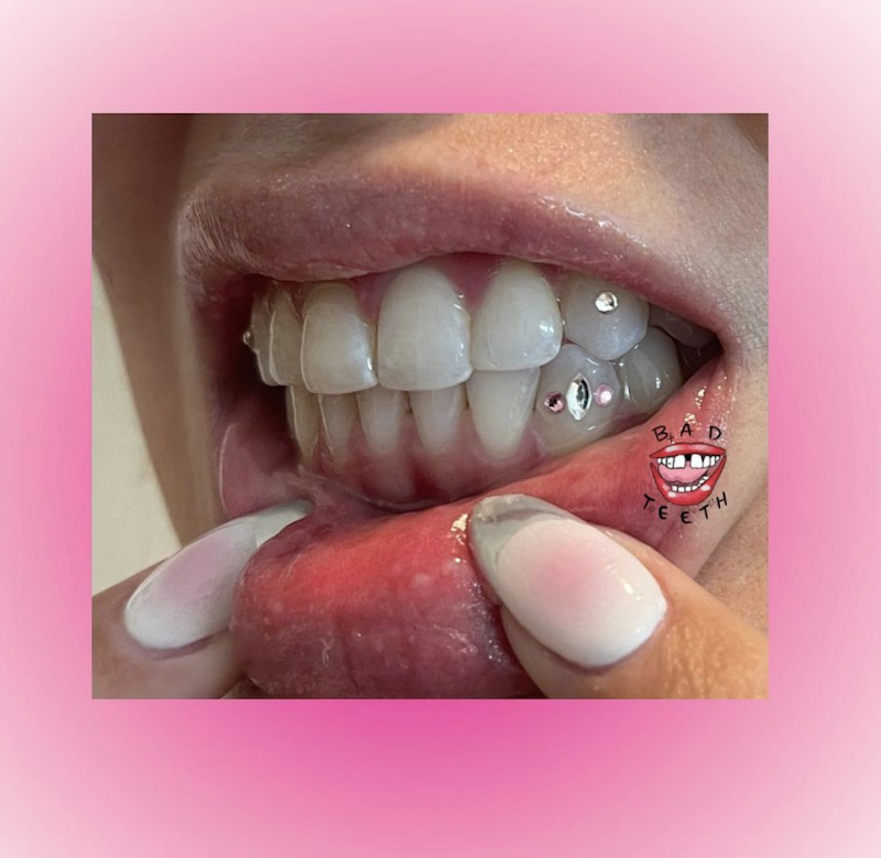 Bad Teeth Gems® Los Angeles Tooth Gems + Whitenings photo 1