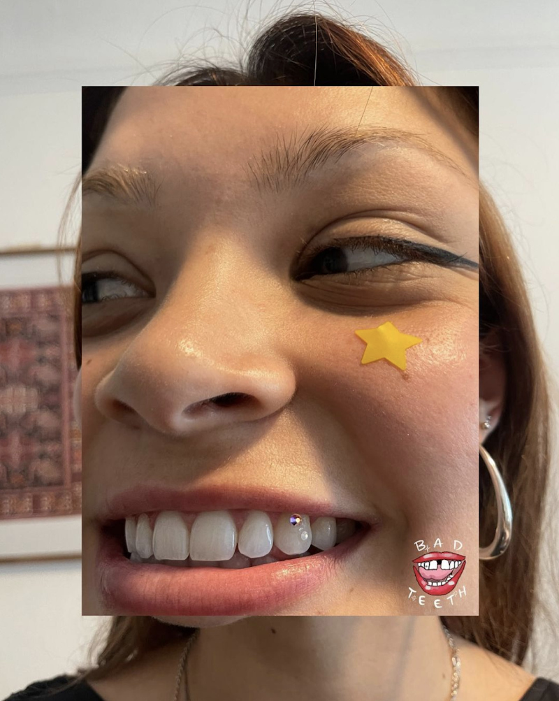 Bad Teeth Gems® Los Angeles Tooth Gems + Whitenings photo 2