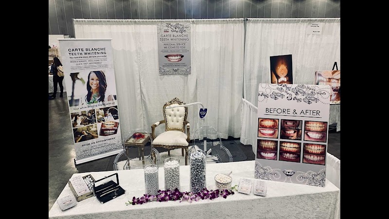 Carte Blanche Teeth Whitening photo 1