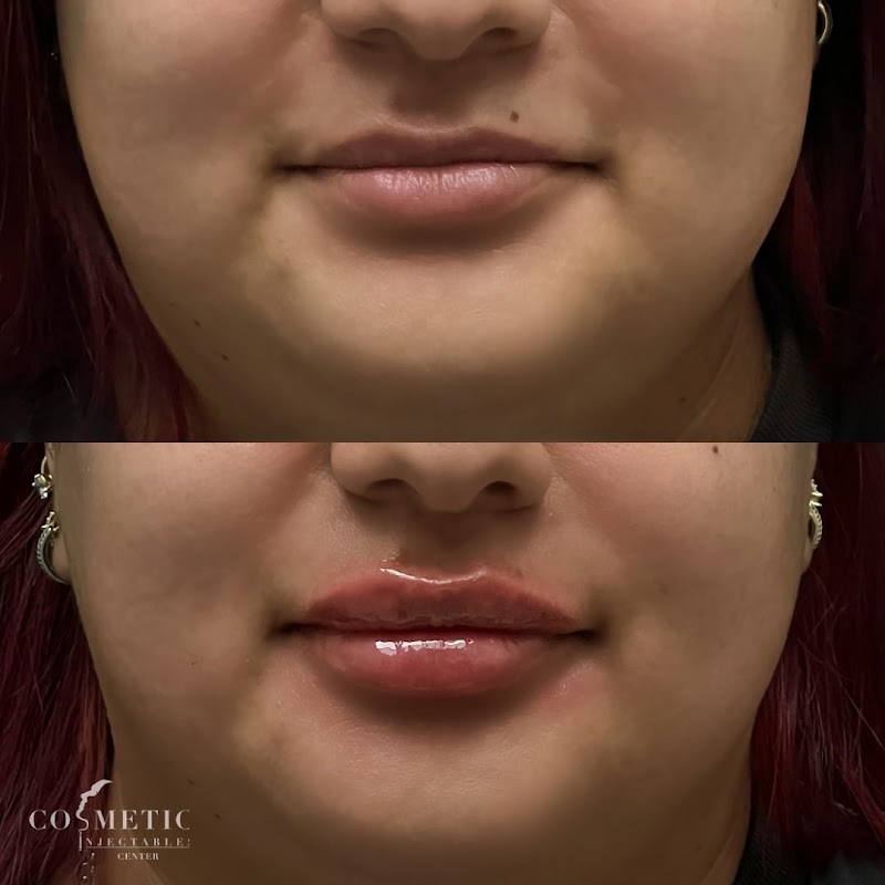 Cosmetic Injectables Center Medspa photo 1