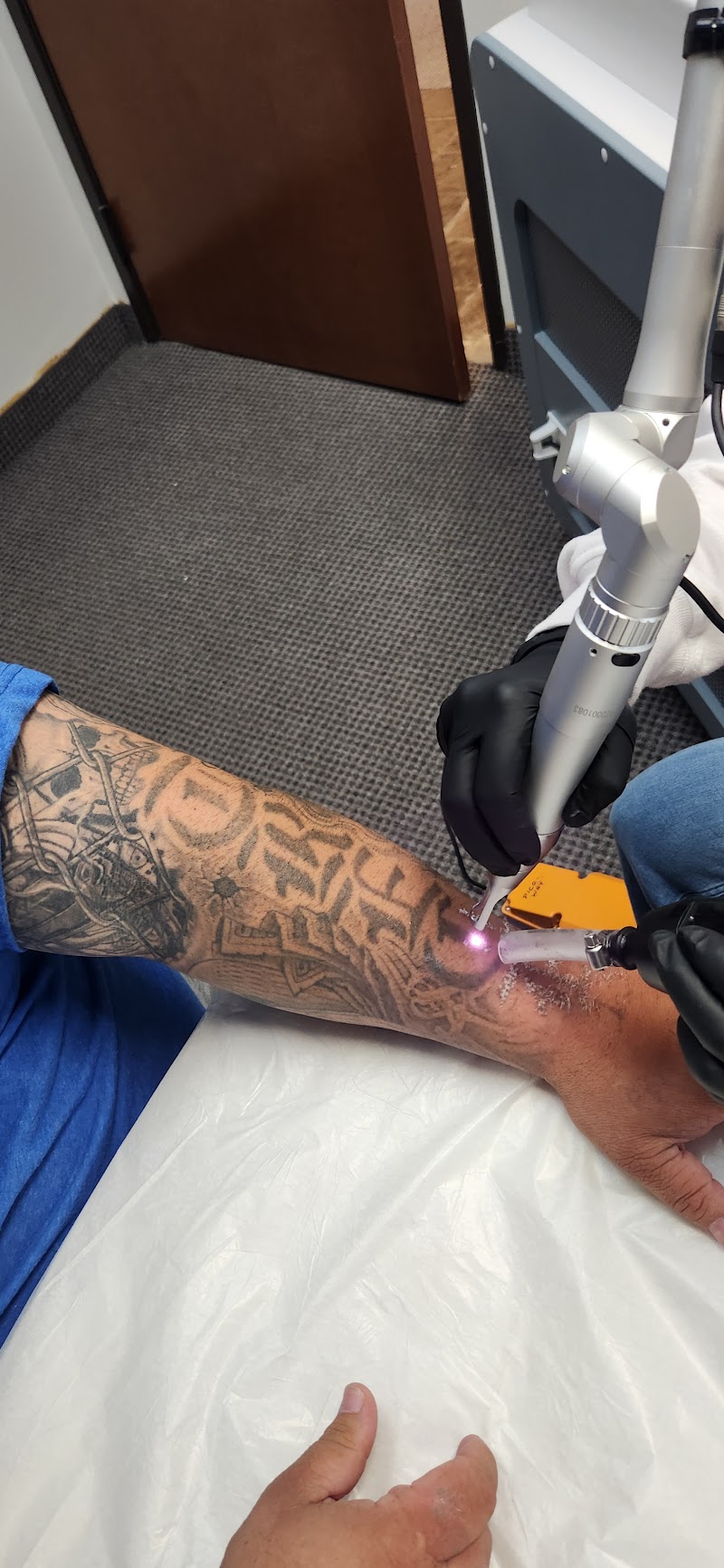 Dallas Tattoo Removal Clinic photo 3