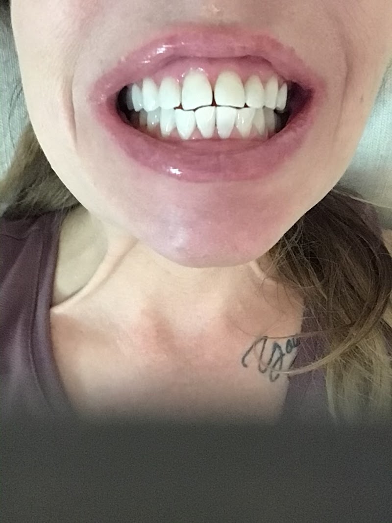 Diamond Shine Professional Teeth Whitening photo 1