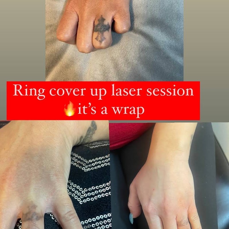 Dtown Laser Tattoo Removal & Aesthetics,LLC