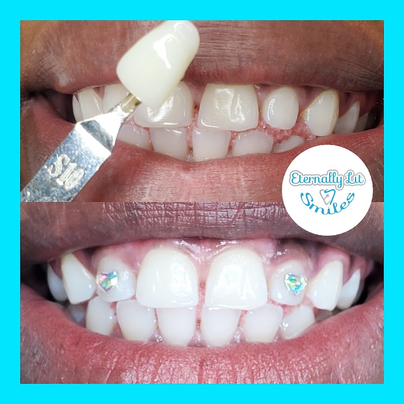 Eternally Lit Smiles llc photo 3