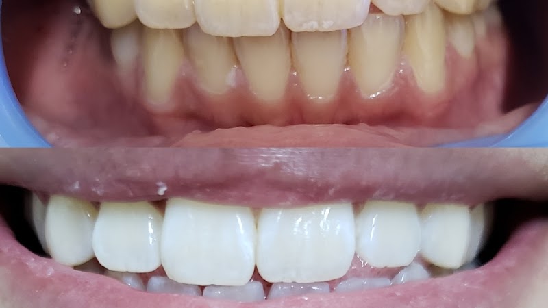 Gems Teeth Whitening photo 1