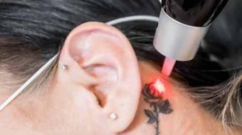 Laser Lounge Dallas photo 1