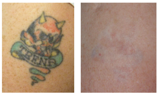 Laser Skin Solutions Jacksonville photo 2