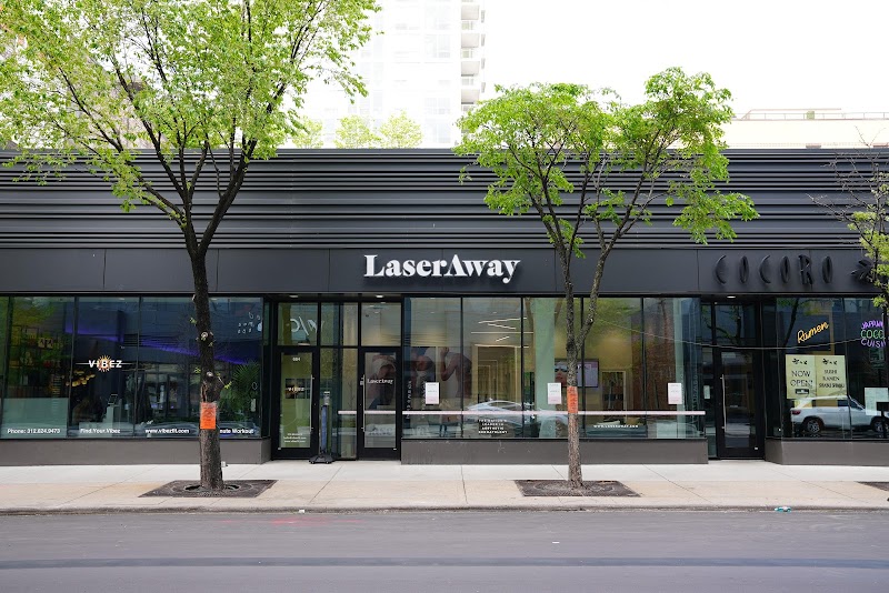 LaserAway River North photo 2