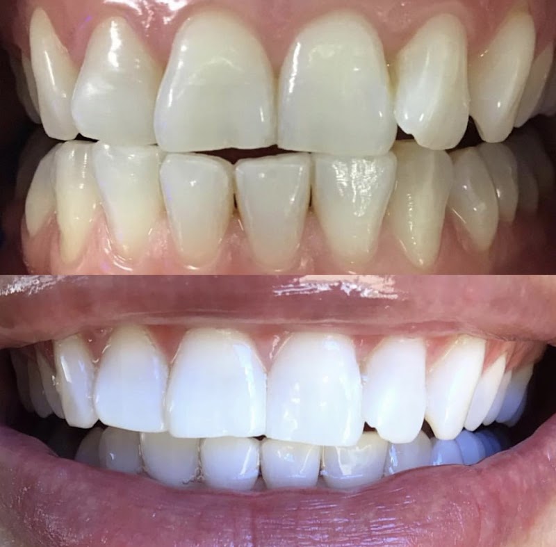 Naturally White Teeth Whitening photo 1