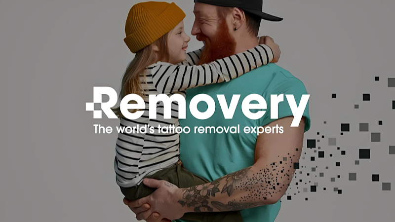 Removery Tattoo Removal & Fading photo 1