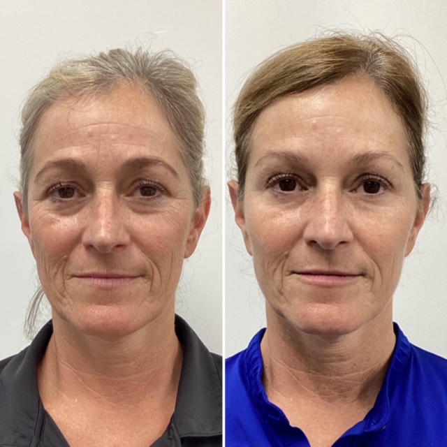 Royal Aesthetics & Injectables photo 1