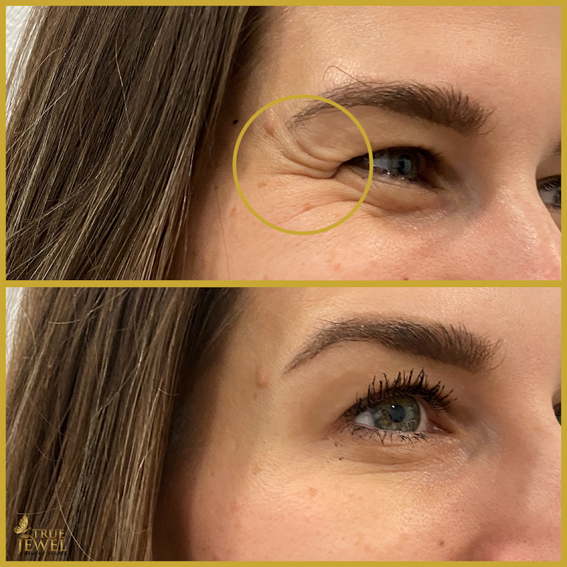 True Jewel Cosmetic & Plastic Surgery Center photo 3