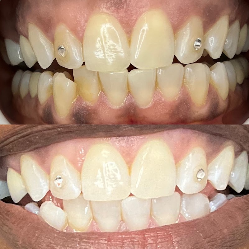 We Whiten Teeth Whitening photo 1