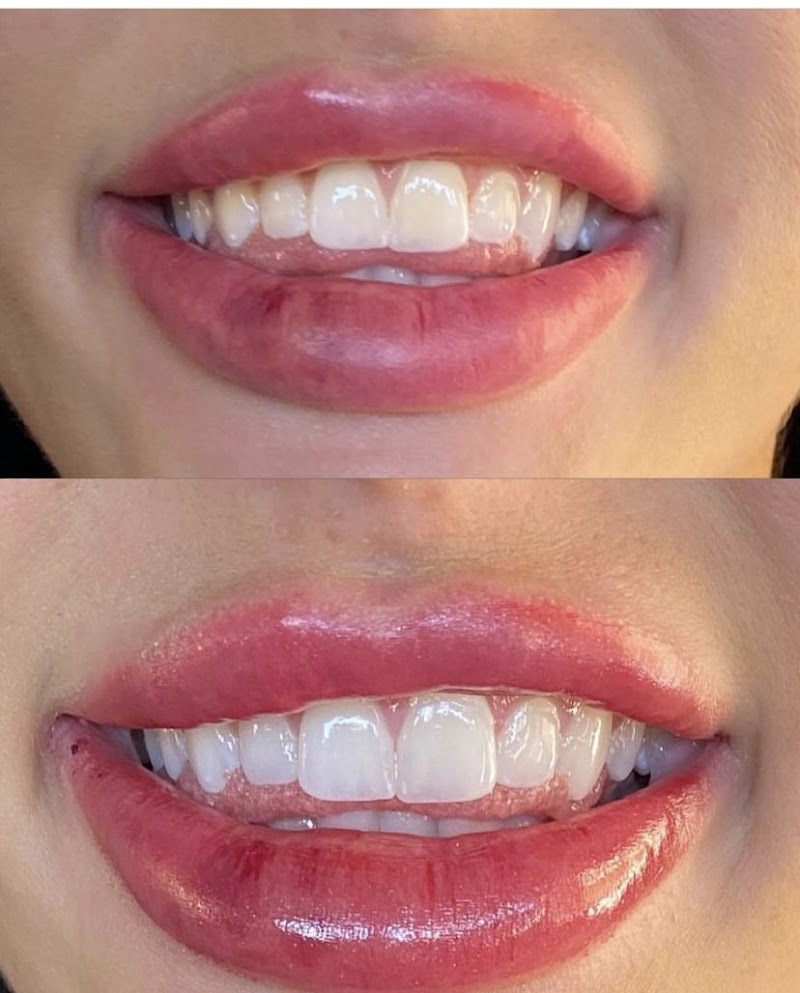 White Teeth Miami photo 1