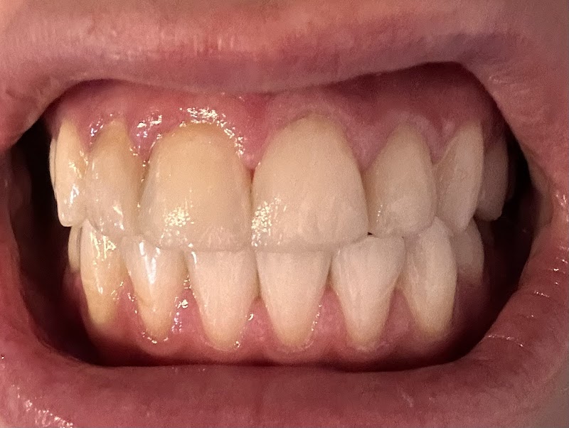 White Teeth USA photo 3