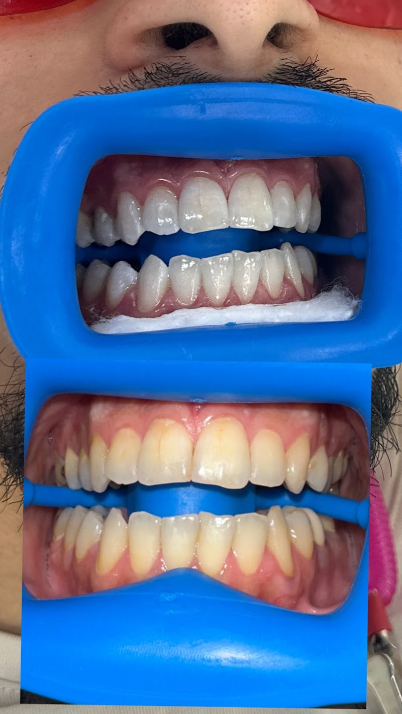 Whitening Bar NYC photo 1